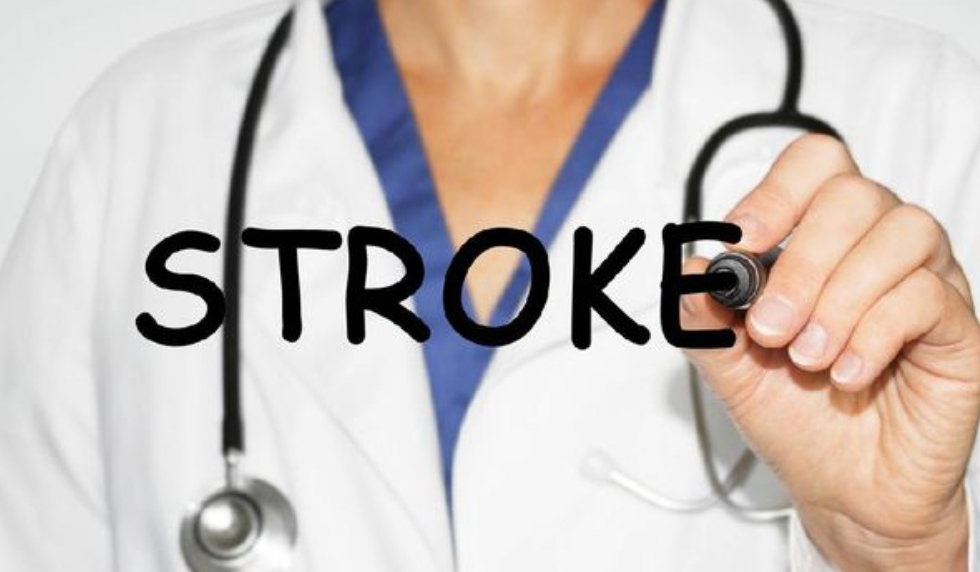 Cara Efektif Tim Dokter Mayapada Hospital Atasi Stroke Sumbatan